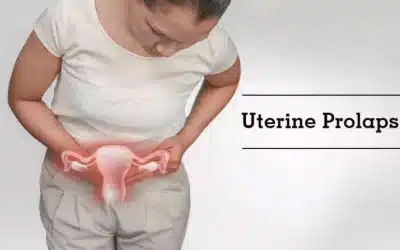 Everything You Need to Know About Uterine Prolapse